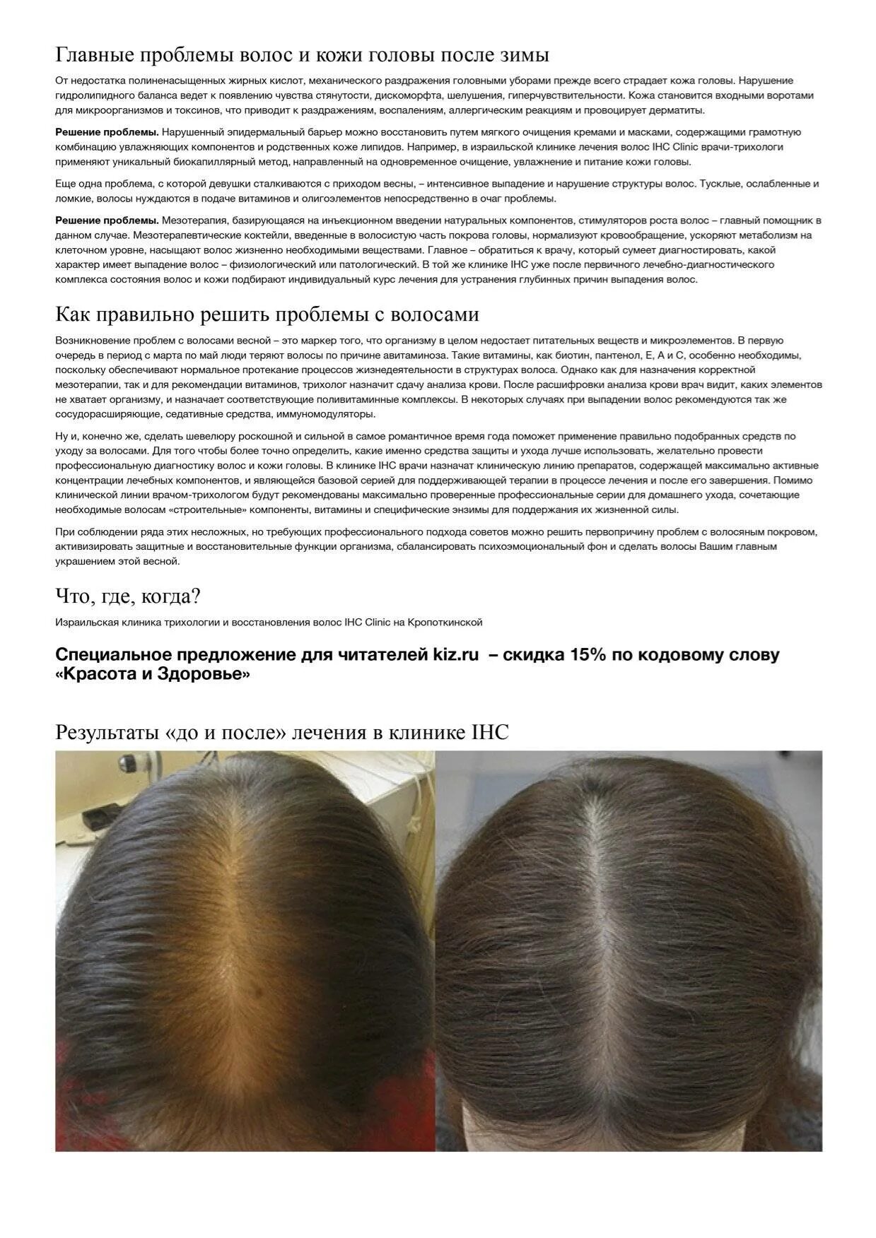 Анализы при выпадении волос. Трихология выпадение волос. Рекомендация при выпадении волос. Причины сильного выпадения волос. Выпадают волосы гормональное