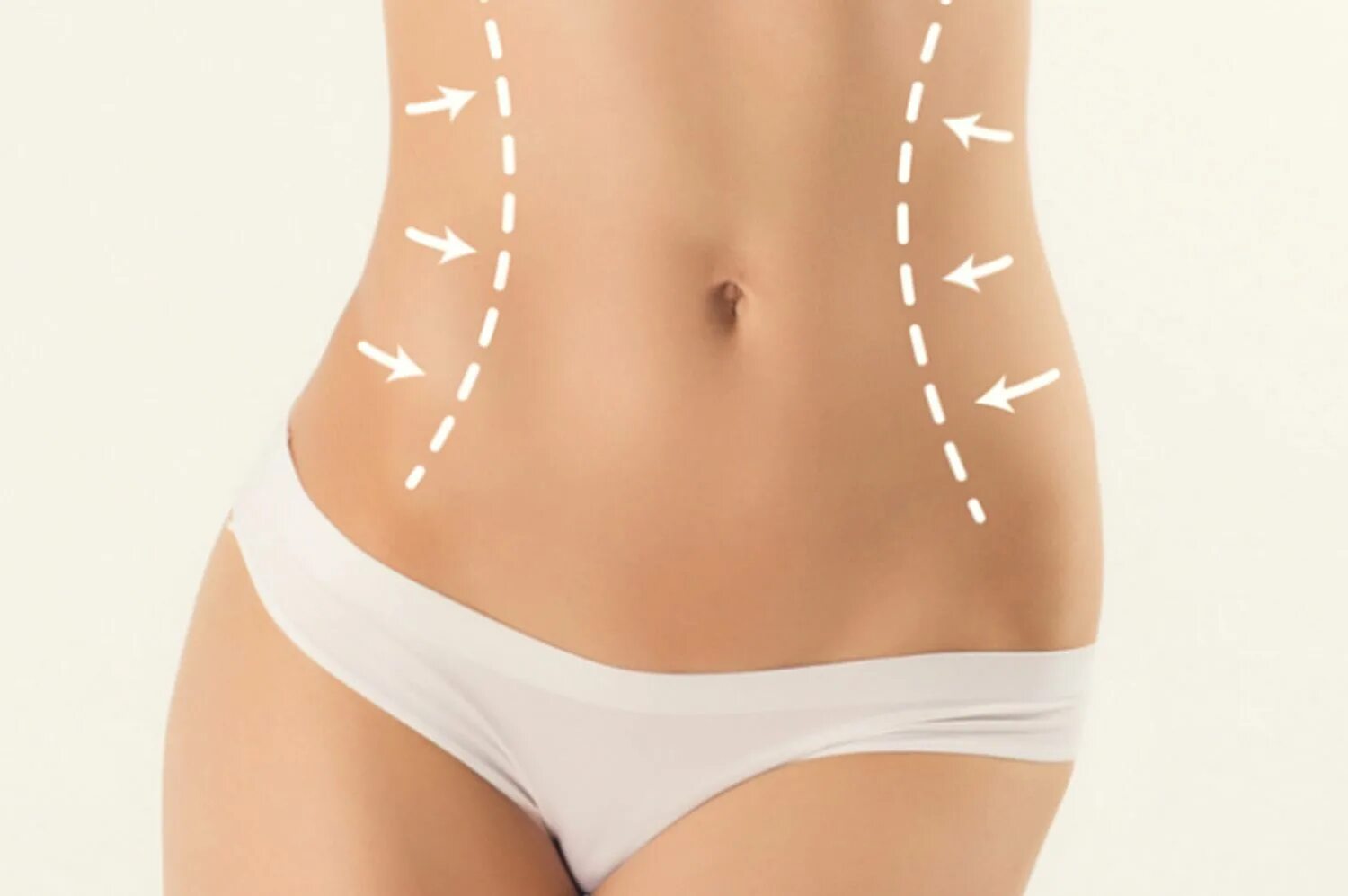 Body contouring. Контуринг живота. Body contouring. Абдоминопластика восстановительный период. Body contouring.