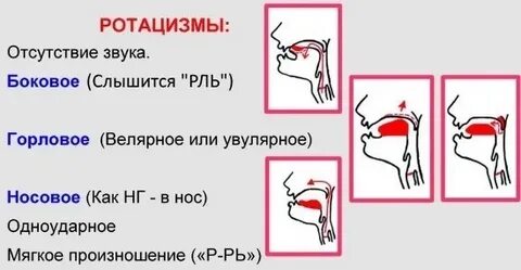 Ротацизм это