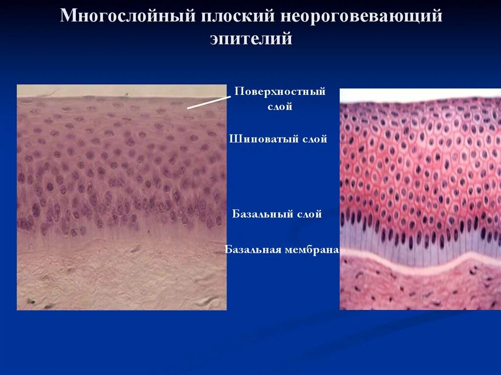 Увеличение больших половых. Многослойный плоский неороговевающий эпителий. Эпителий роговицы гистология. Эпителиальная ткань ороговевающий неороговевающий. Однослойный плоский неороговевающий эпителий препарат.