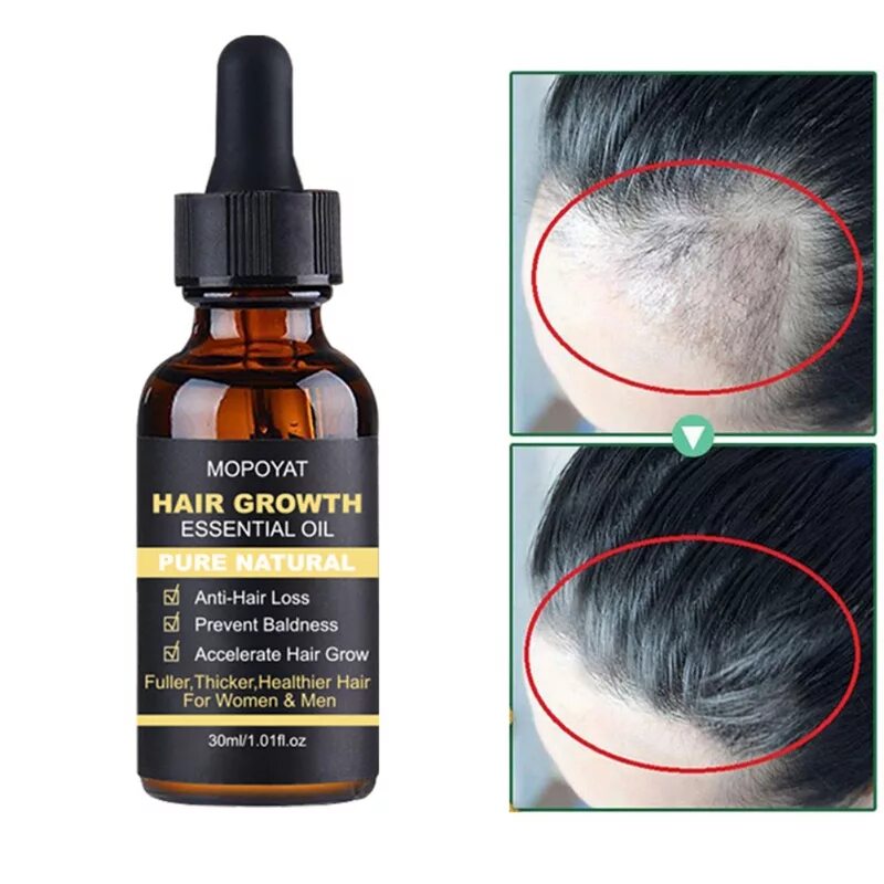 Какую маску от выпадения. Hair growth Essence Oil. Для роста волос. Средство для роста волос. Маски для выпадения для роста волос.