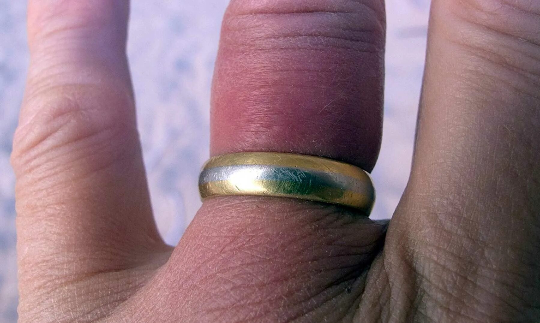 как снять кольцо пальца при беременности. кольцо с опухшего пальца с ниткой. как снять кольцо пальца при беременности. толстое кольцо на пальце. снятое обручальное кольцо.