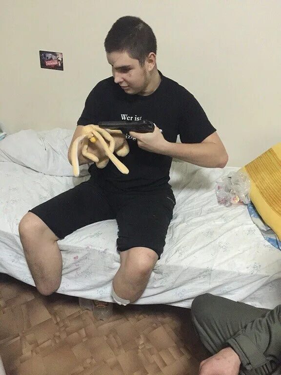 Блоггер руслан набиев. Инвалид без рук без ног. Безногий инвалид. Русский без ног. Оскар писториус без протезов.