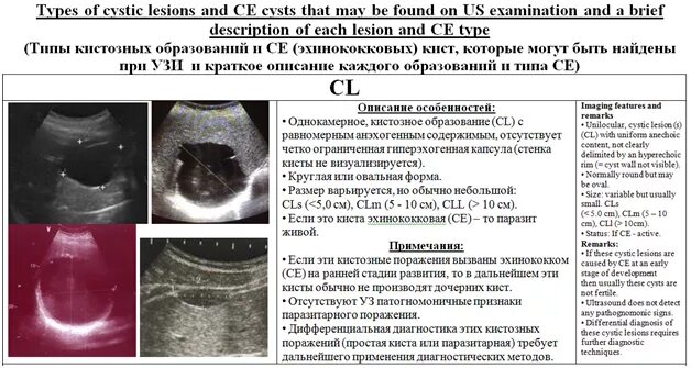 Кистозное образование печени. Эхинококковая киста печени на УЗИ стадии. Эхинококковая киста на УЗИ классификация. Классификация эхинококковых кист на УЗИ печени. Классификация эхинококкоза печени УЗИ.