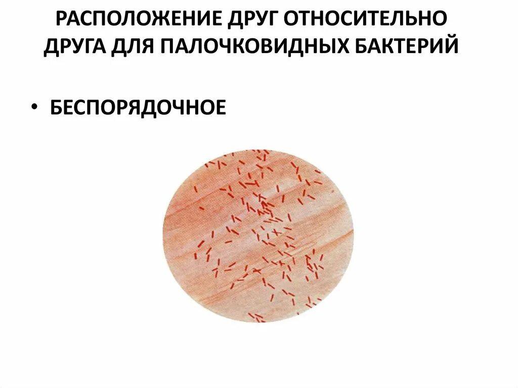 Эшерихии кишечная палочка. Escherichia coli препарат. Escherichia coli по граму. Кишечная палочка микробиология. Escherichia coli препарат.