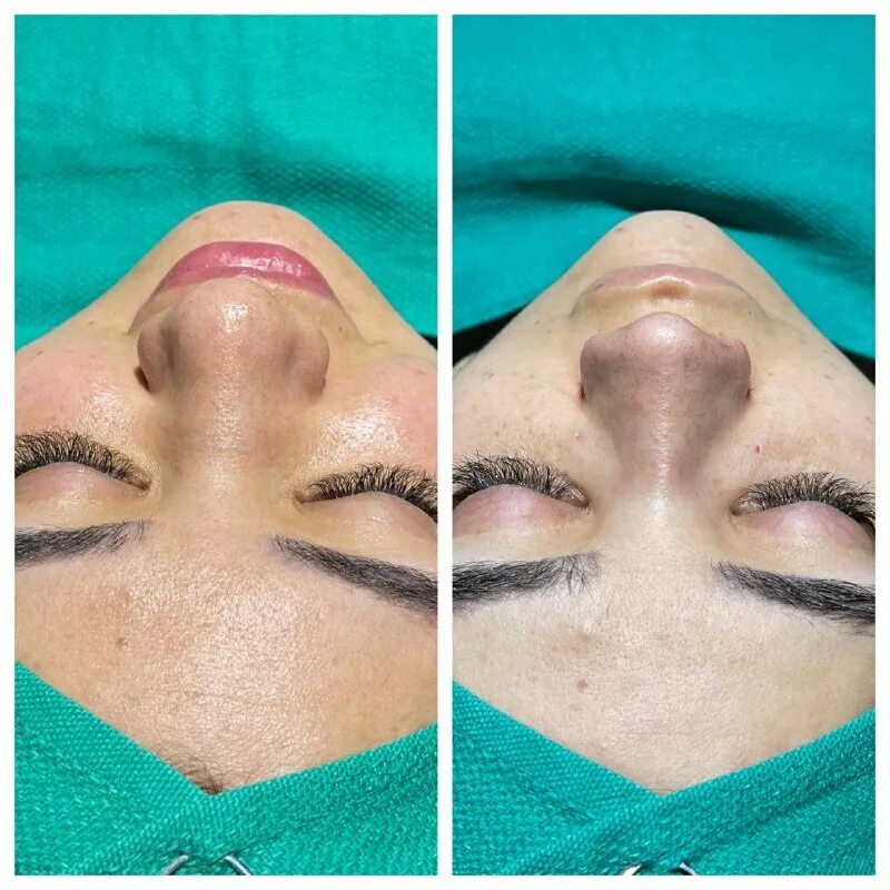 центр ринопластики