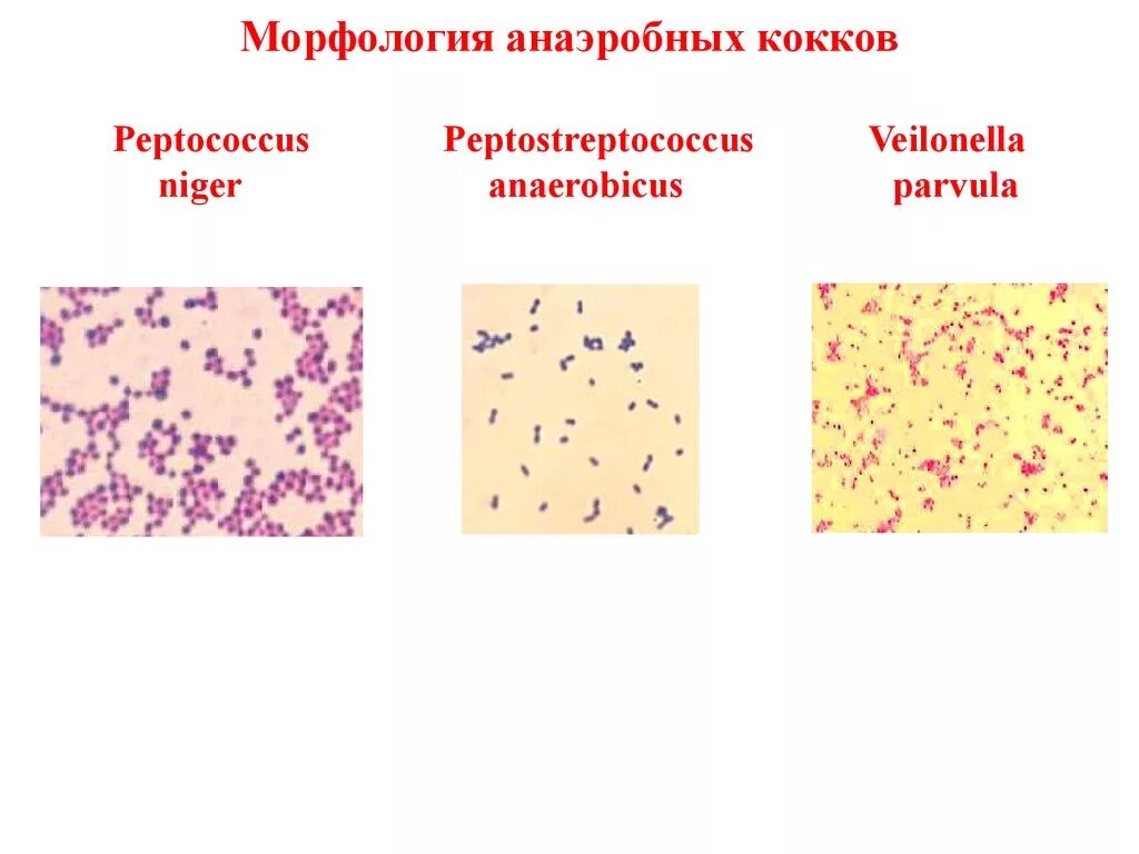 Peptostreptococcus. Пептококки пептострептококки вейлонеллы. Анаэробные грамположительные кокки. Анаэробные грамположительные кокки неспорообразующие. Вейлонеллы морфология.