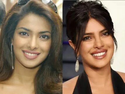 Priyanka Chopra before-after pics Transformation Tuesday: Priyanka 