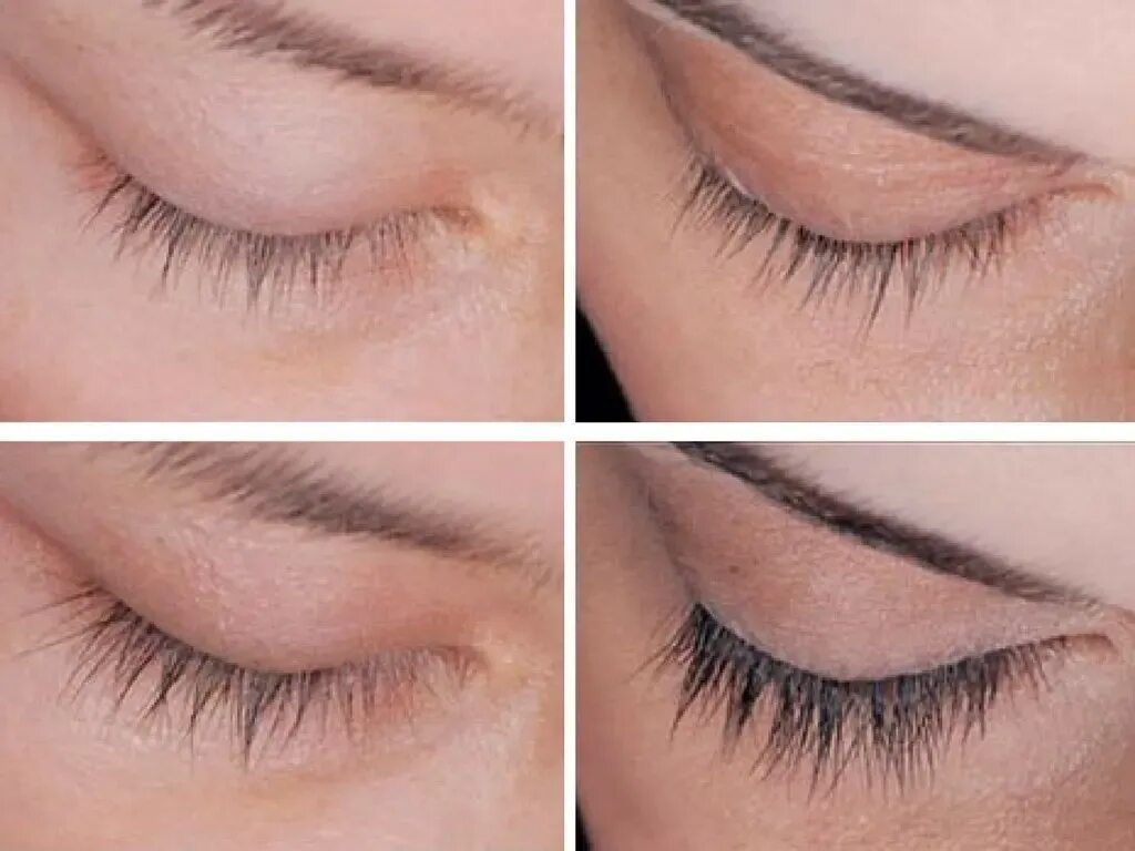 Сыворотка для бровей brow lash. Топ Лэш сыворотка для ресниц. Сыворотка для ресниц до и после. Сыворотка для ресниц grow. Наращивание бровей приспособление.