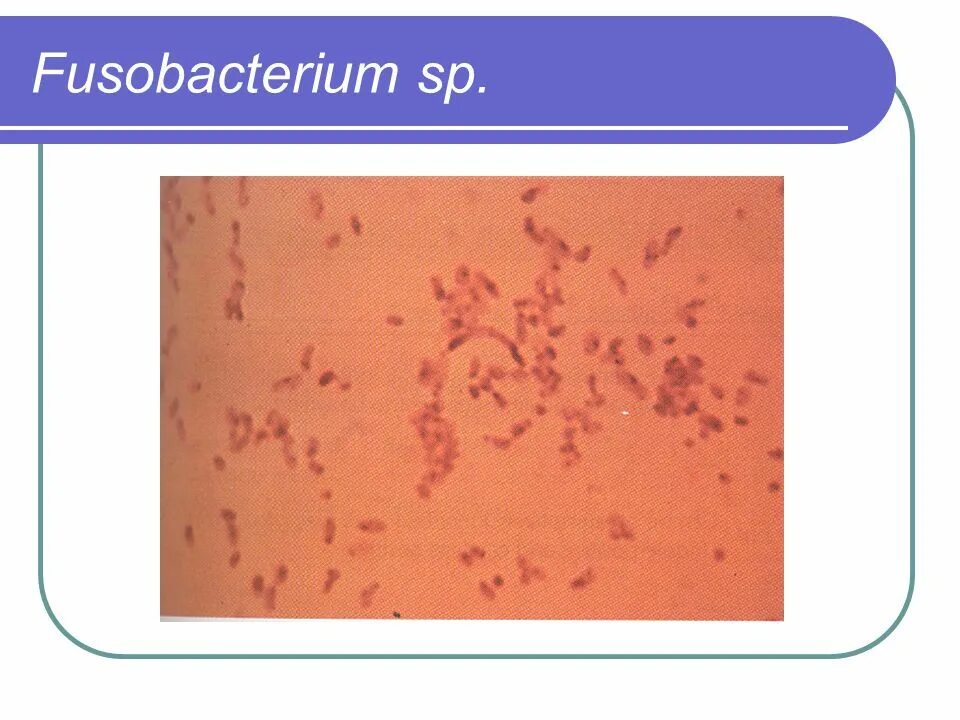 Fusobacterium spp. Fusobacterium nucleatum морфология. fusobacterium necrophorum морфология. фузобактерии микробиология. фузобактерии и спирохеты.