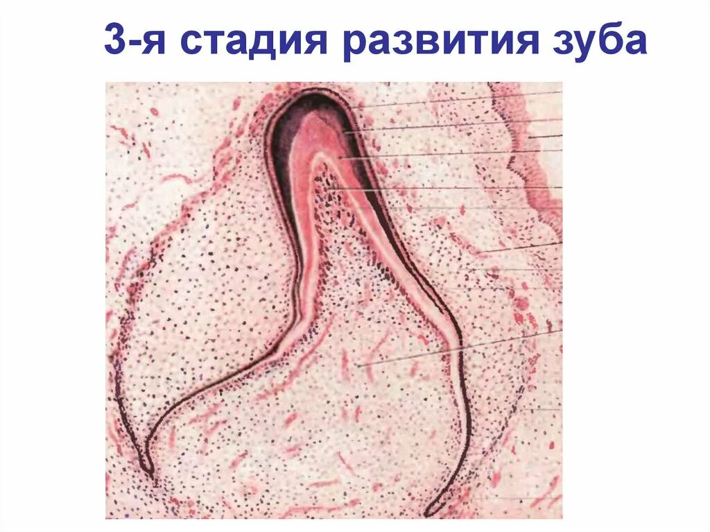 Развитие зуба 3 стадия гистология. Стадии развития зуба гистология. Развитие зуба 1 стадия гистология. Поздняя стадия развития зуба гистология препарат. Развитие зубов у человека