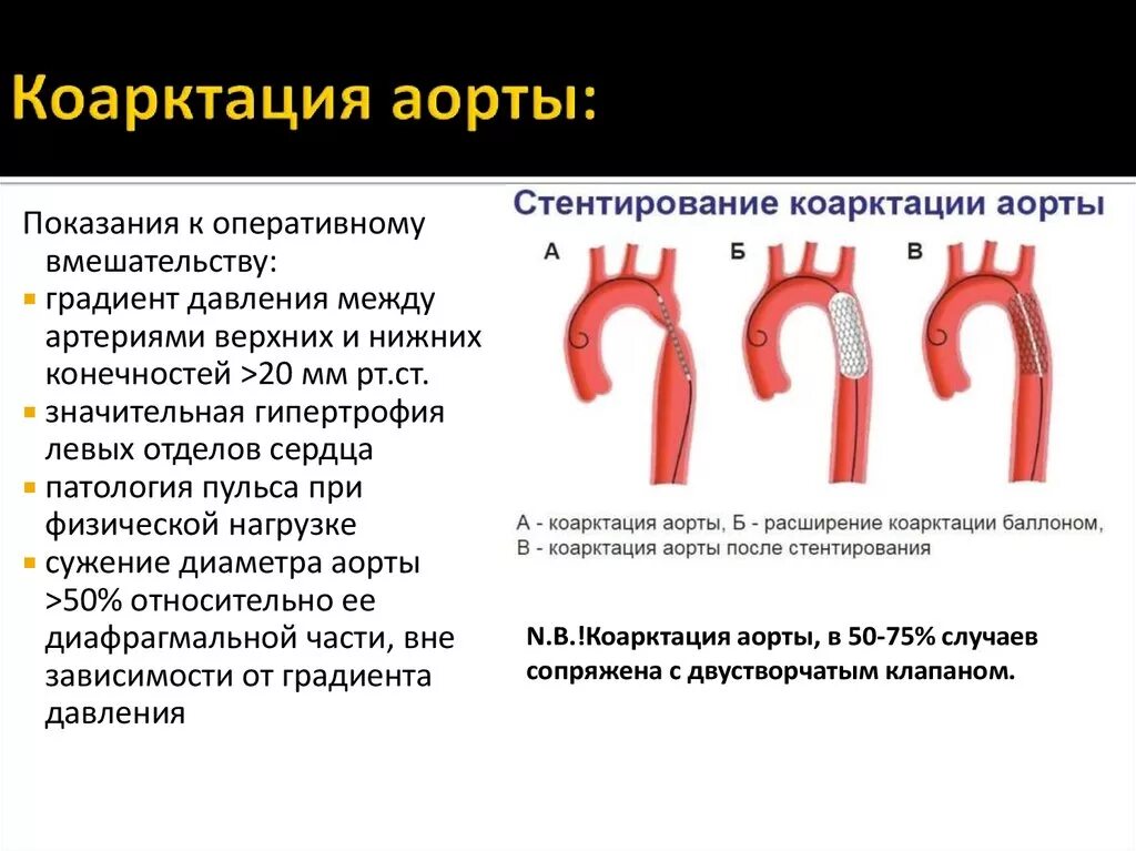 Аортальный градиент норма