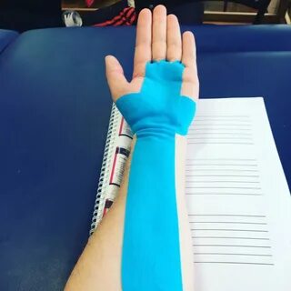 Тейпирование при туннельном синдроме