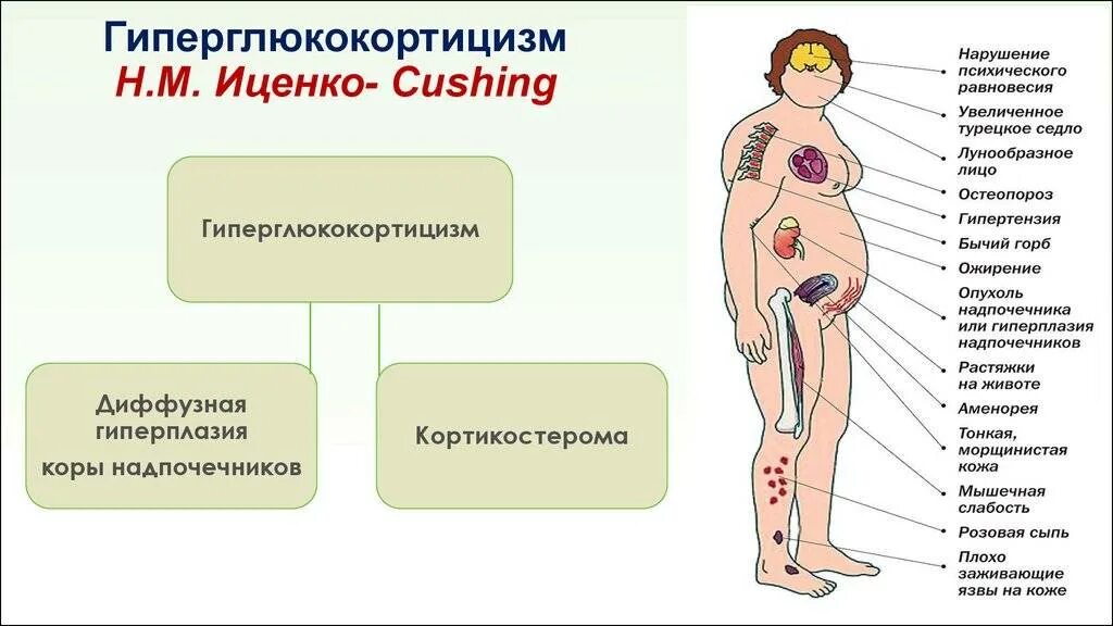 Болят ли надпочечники. Синдром Иценко -Кушинга клиника. Гиперфункция надпочечников (синдром Иценко-Кушинга). Врожденная гиперплазия коры надпочечников симптомы. Гиперплазия коры надпочечников.