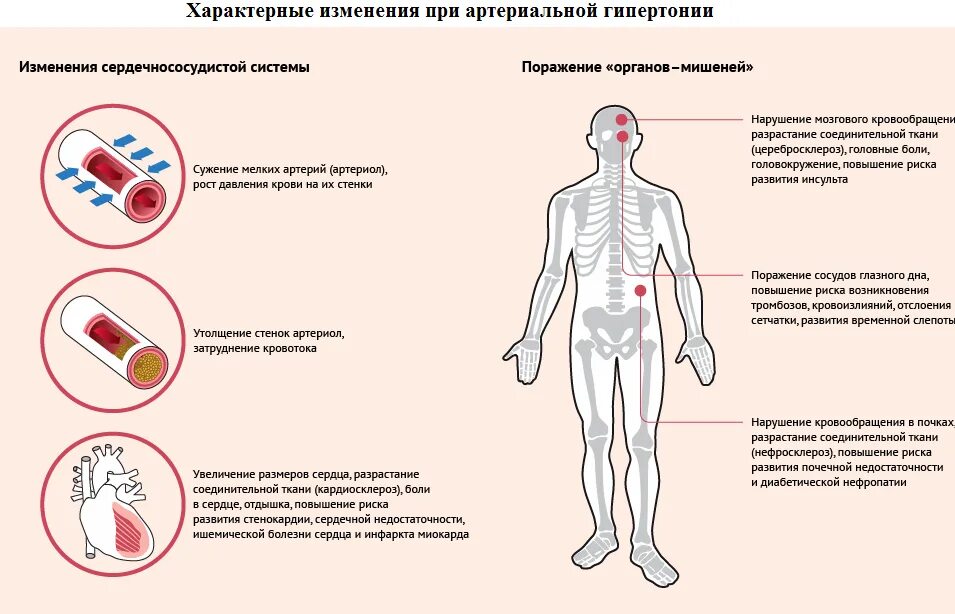 Симптомы артериальной гипертонии. Артериальная гипертензия симптомы заболевания. Гипертоническая болезнь и артериальная гипертензия симптомы. Симптомов характерны для артериальной гипертензии. Органы-мишени при артериальной гипертензии.