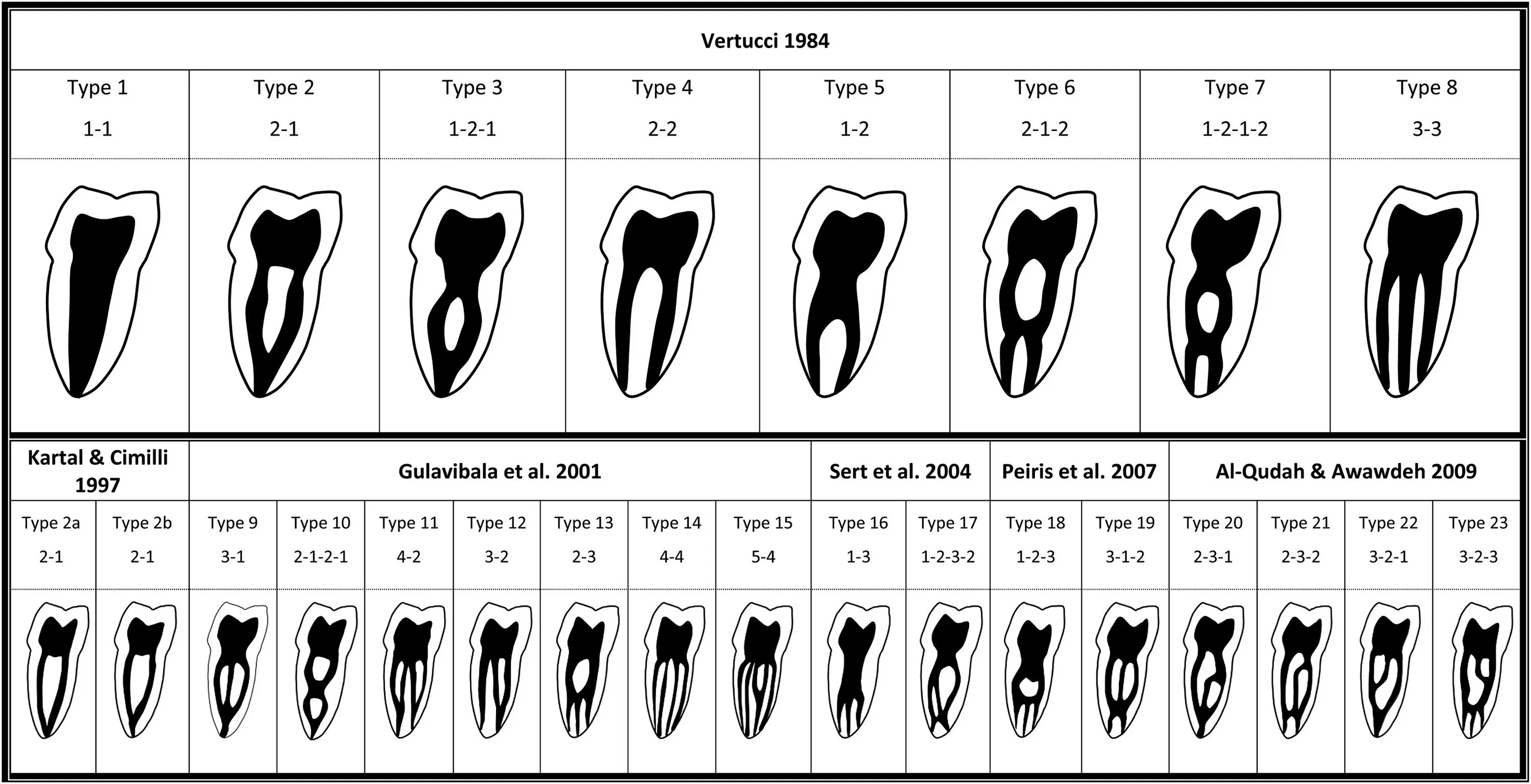 Классификация корневых каналов Vertucci. Типы конфигурации корневых каналов по Вертуччи. Топография корневых каналов 16 зуба. Корневые каналы зубов схема. Формы корневых каналов