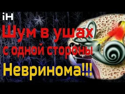 В одном ухе пульсирующий шум