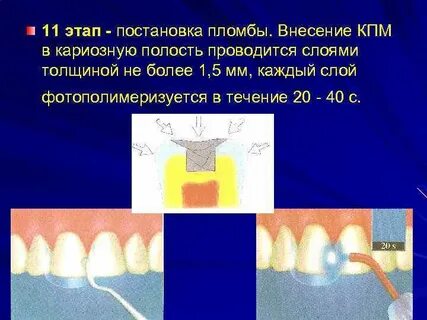 Полость провожать