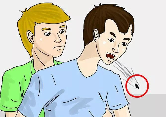 Глаз дыхательных путей попадание. Попадание инородного тела в дыхательные пути. Глаз дыхательных путей попадание. Неотложные мероприятия при инородном теле дыхательных путей. Причины попадания инородного тела в дыхательные пути.