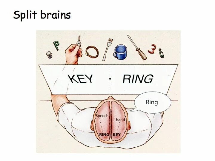 Split brain. Эксперимент Сперри. Сперри расщепленный мозг. Эксперименты с расщепленным мозгом. Роджер Сперри эксперимент.