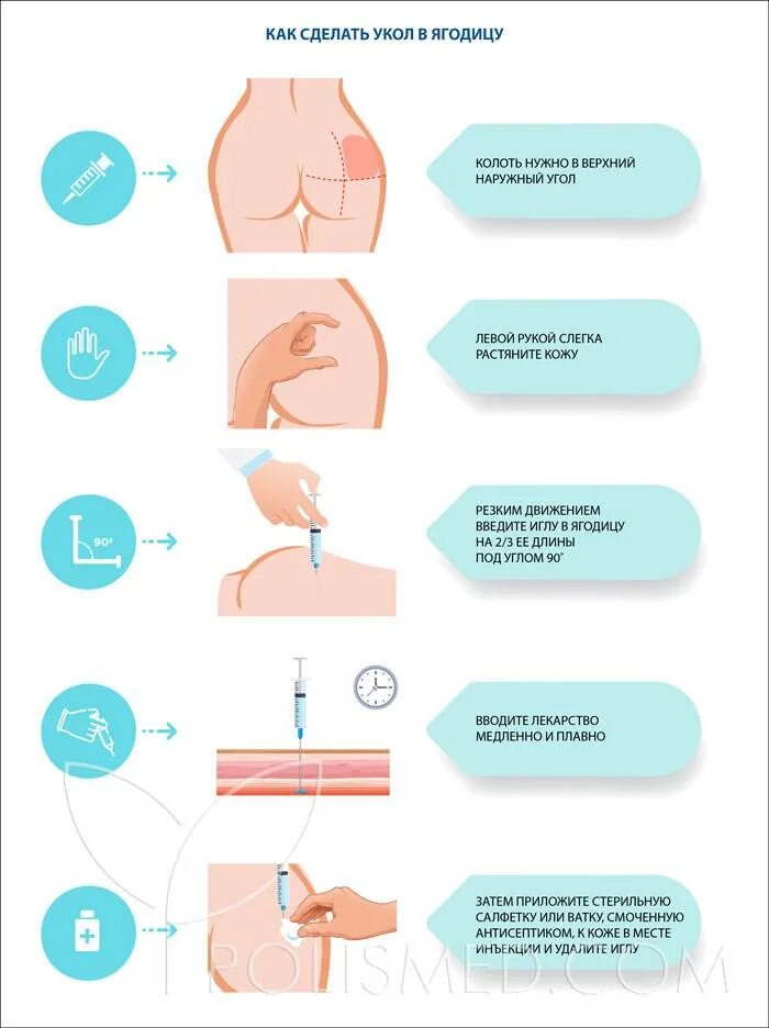 Как не больно сделать укол в ягодицу