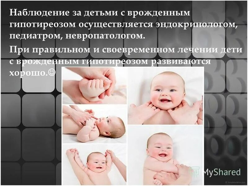 Гипоториоз. Микседема и тиреотоксикоз. Гипоториоз. Гипоториоз. Претибиальная микседема тиреотоксикоз.