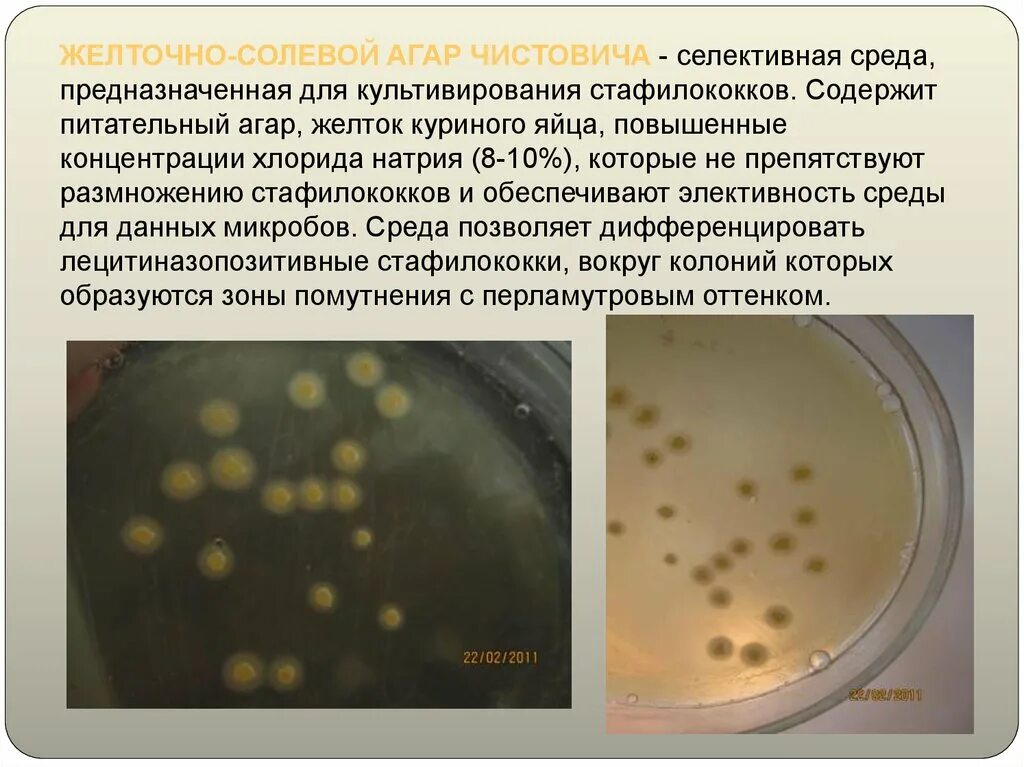 Желточно-солевой агар (ЖСА). Золотистый стафилококк на ЖСА. Питательная среда для культивирования стафилококков. Среда желточно солевой агар. Staphylococcus aureus среда