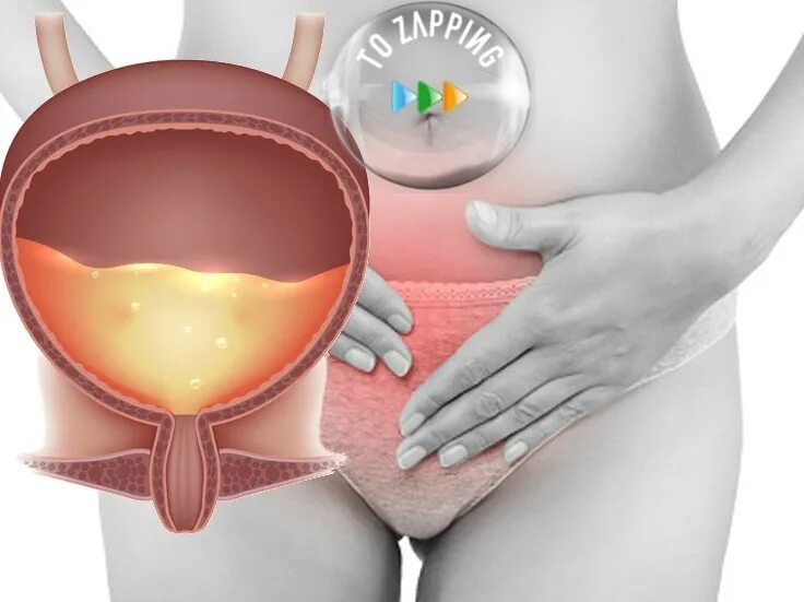 болит когда писаю женщина. бели при мочеиспусканит. жжение при мочеиспускании у мужчин причины. болит когда писаю женщина. частое мочеиспускание причины.