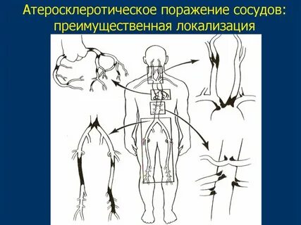 Основная локализация