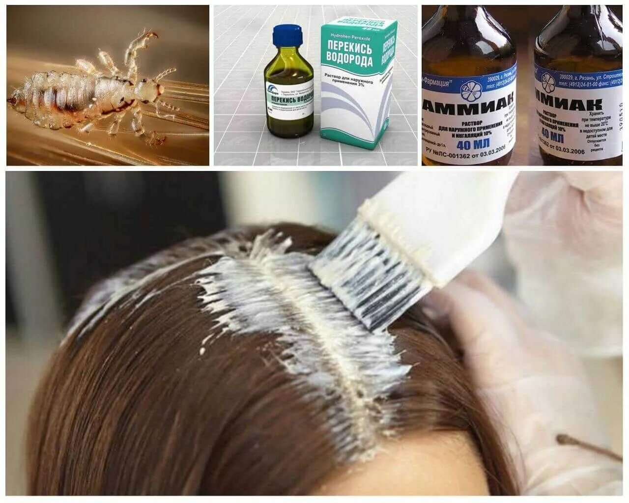Чем можно обработать вшей. Чем можно обработать вшей. Способы избавления от гнид. Вычесывание вшей. Средство от избавления гнид.