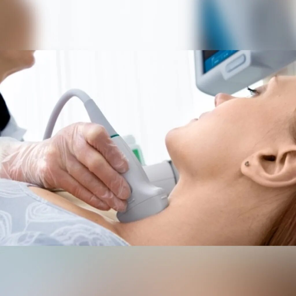 сделать узи в медицинском центре. экран узи аппарата. узи. сделать узи в медицинском центре. центр медицины плода на сикейроса.