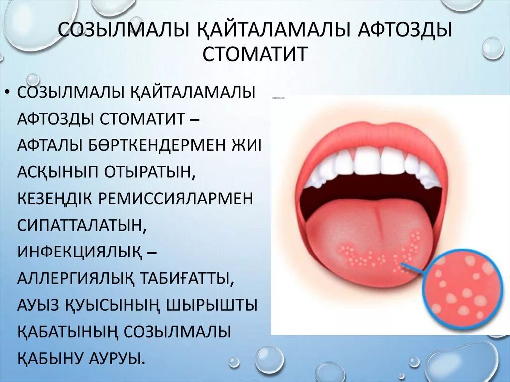 Как быстро и эффективно вылечить стоматит. Афтозный стоматит у детей. афтозный стоматит полости рта.