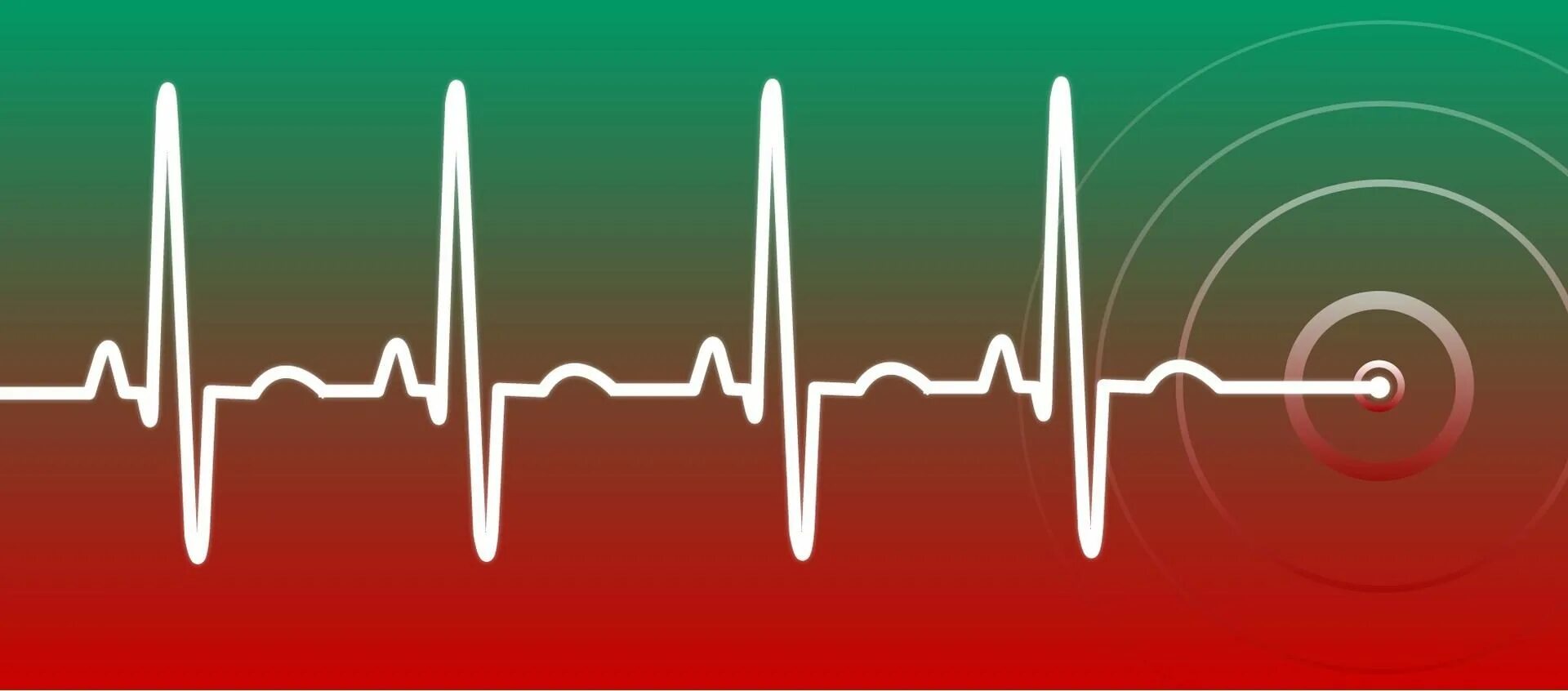 Легкое сердцебиение. Кардиограмма сердца. Ритм сердца. Пульс. Сердцебиение кардиограмма.