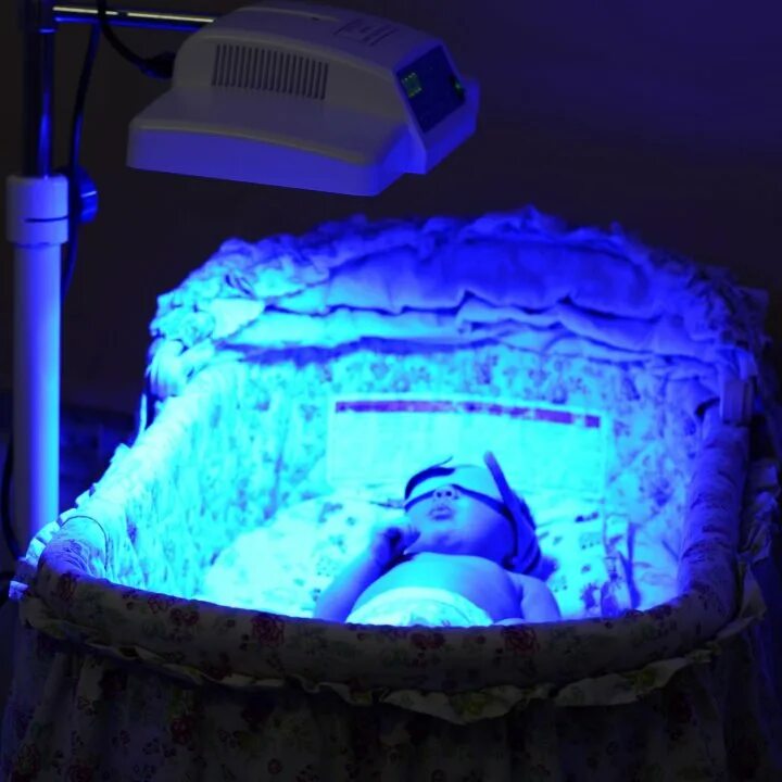 лампы для лечения желтушки у новорожденных. лампа для желтушка у новорожденных. уф лампа от желтушки для новорожденного. лампа для лечения желтушки у новорожденных. лампа для фототерапии "amelux / ftl".