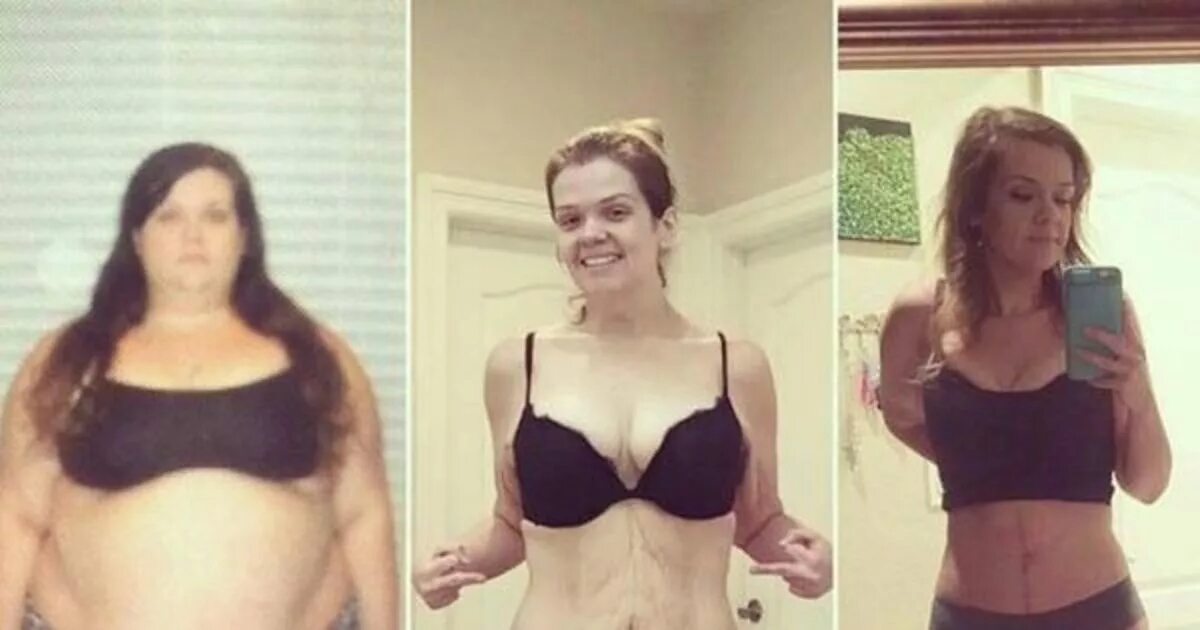 Amazing transformation