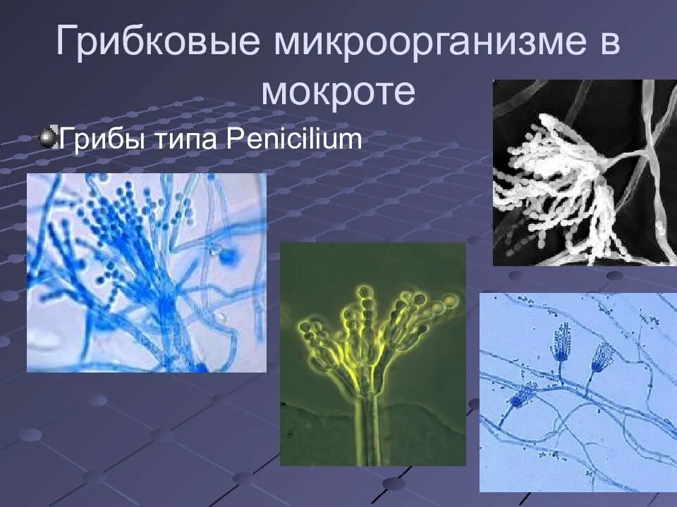 Грибковые бактерии. Мицелий грибов в мокроте. Грибы в мокроте микроскопия.