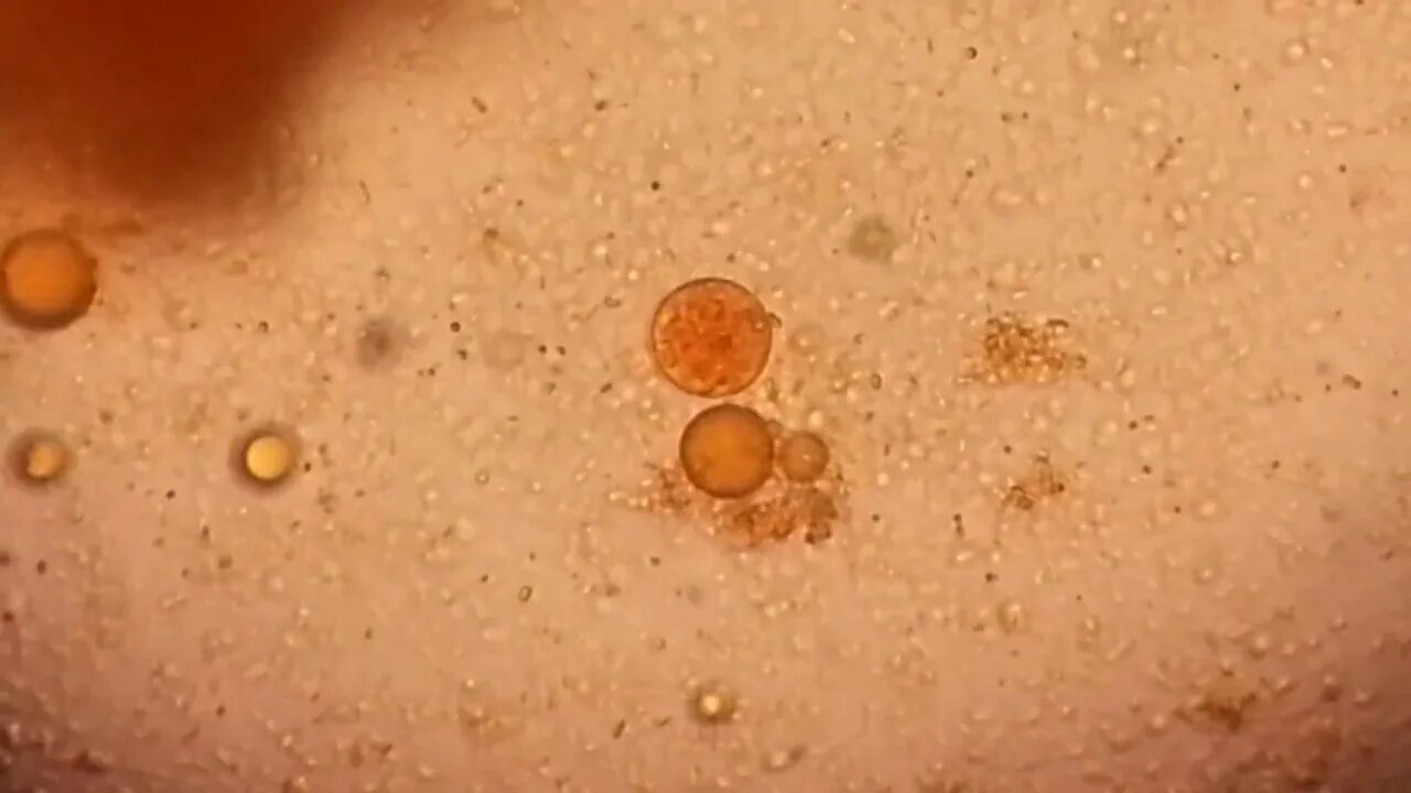 Цисты Entamoeba. Entamoeba coli зрелая циста. Entamoeba coli в кале