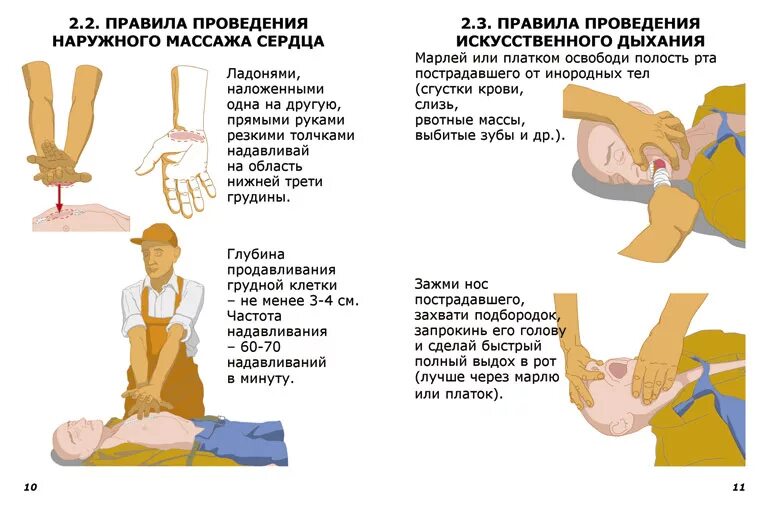 Правила выполнения искусственного дыхания. Непрямой массаж сердца и искусственное дыхание техника выполнения. Навыки проведения искусственного дыхания и непрямого массажа сердца. Правила проведения непрямого массажа сердца и искусственной. Принцип оказания первой помощи непрямой массаж сердца.