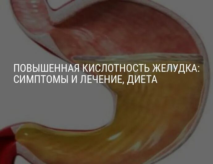 Повышена кислота симптомы. Повышенное кислотообразование в желудке. Повышенная кислотность желудка. Симптомы повышенной кислотности. Повышенная кислотность желудка симптомы.