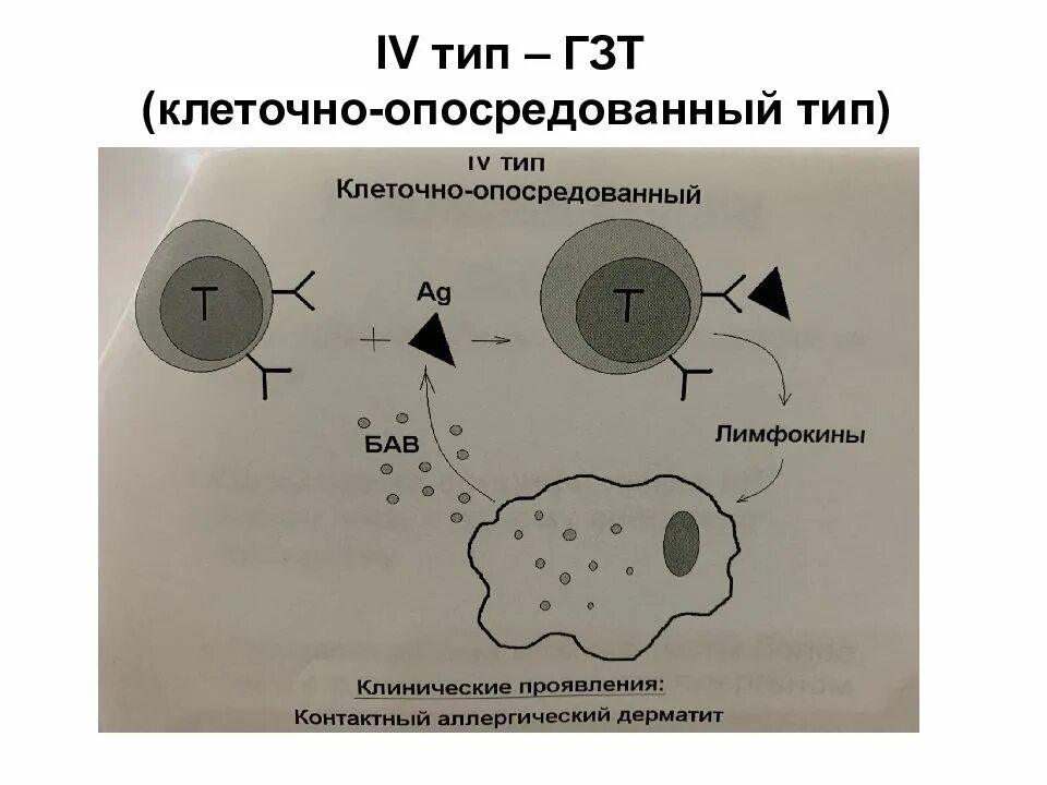 Гзт для мужчин купить. Гиперчувствительность замедленного типа. Клеточно опосредованный Тип аллергических реакций. Типы гиперчувствительности иммунология. Гиперчувствительность замедленного типа схема.