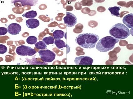 Бластные клетки