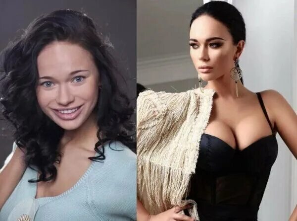 Яна Кошкина до и после пластики, фото, биография, личная жизнь - 300 Экспертов
