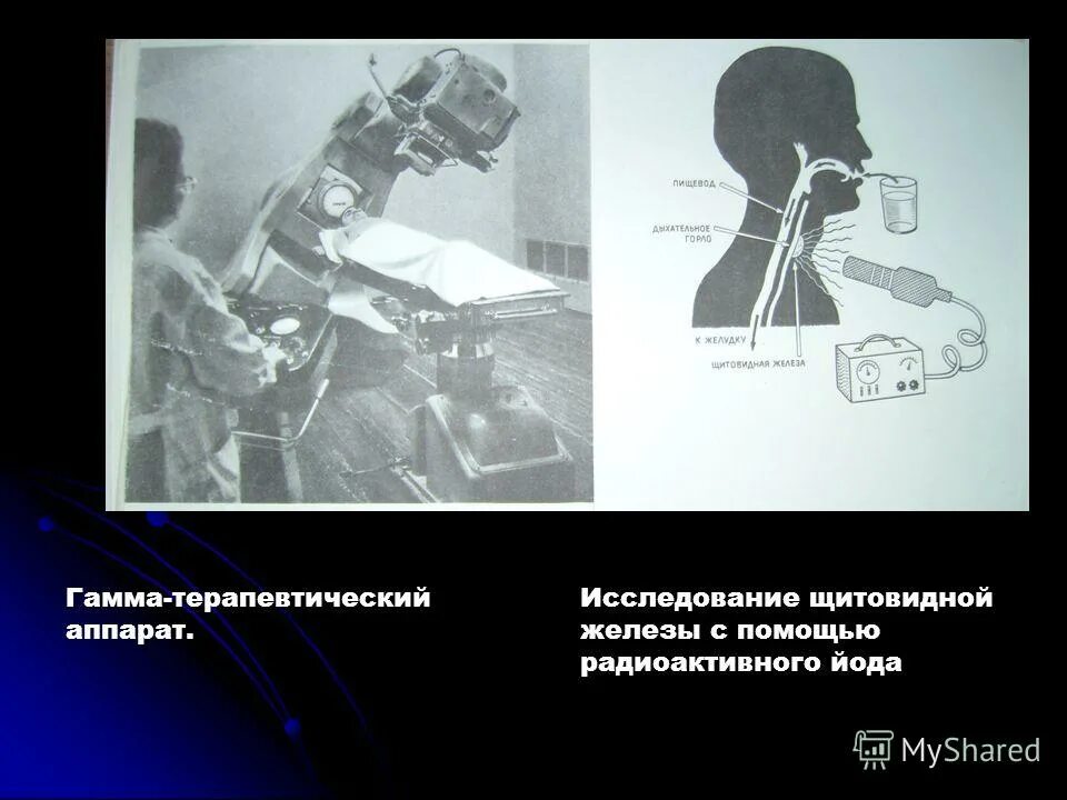 Радиоактивный йод щитовидная