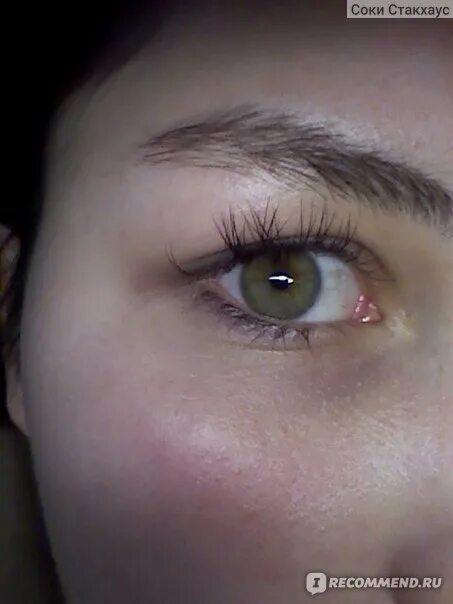 Выпадение нарощенных ресниц. Выпадение ресниц причины. Ресницы после снятия нарощенных. Выпадение ресниц у женщин. От выпадения ресниц.
