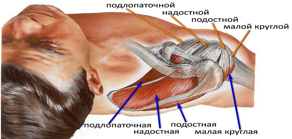 Разрыв надостной мышцы лечение. Ротаторная манжета плечевого сустава мышцы. Тендинит сухожилия надостной. Тендинопатия сухожилия надостной мышцы плечевого. Тендинит сухожилия надостной мышцы.