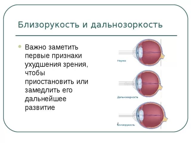 Причины возникновения дальнозоркости. Причины развития близорукости и дальнозоркости. Профилактика близорукости и дальнозоркости. Причины возникновения миопии. Причины возникновения близорукости.