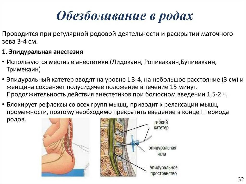 Боли в спине после эпидуральной. Эпидуральная анестезия как делают. Эпидуральная анестезия при родах. Спинальная и эпидуральная анестезия. Эпидуральная анестезия и роды.