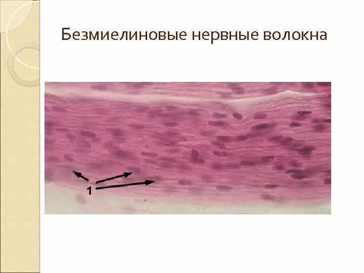 Мякотные миелиновые нервные волокна. Мякотные миелиновые волокна. Безмиелиновые нервные волокна гистология. Безмиелиновое волокно препарат гистология. Мякотные нервные волокна гистология.