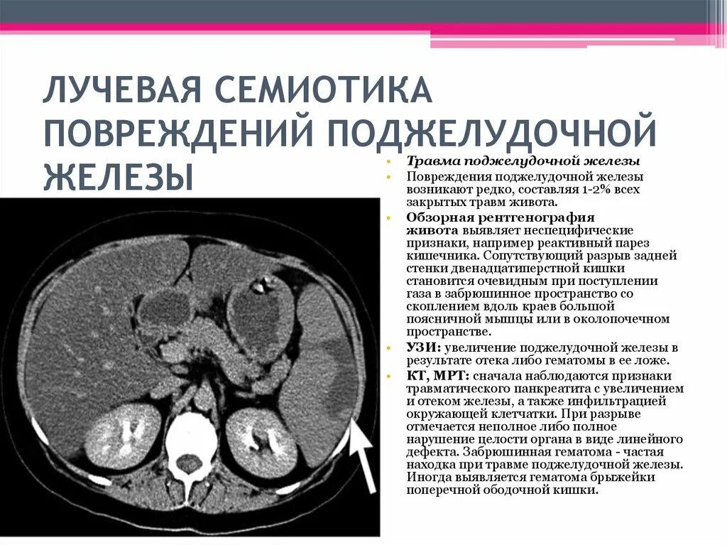 Поджелудочная железа фиброзные изменения. Кт признаки хронического панкреатита. Жировая дистрофия поджелудочной железы мрт. Инволюция поджелудочной железы кт. Инфильтрация поджелудочной железы УЗИ.