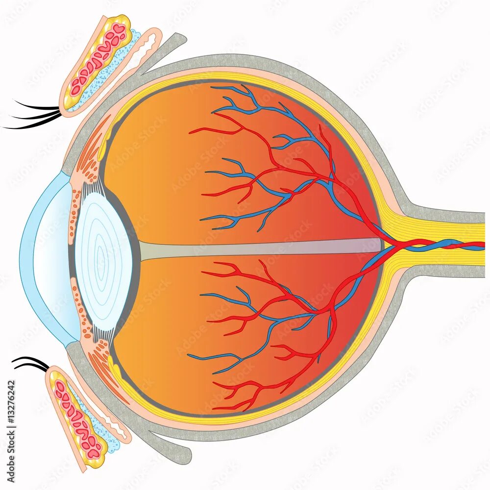 Миопическая стафилома сетчатки. Миопический конус глазное дно. Узкий миопический конус глазное дно.